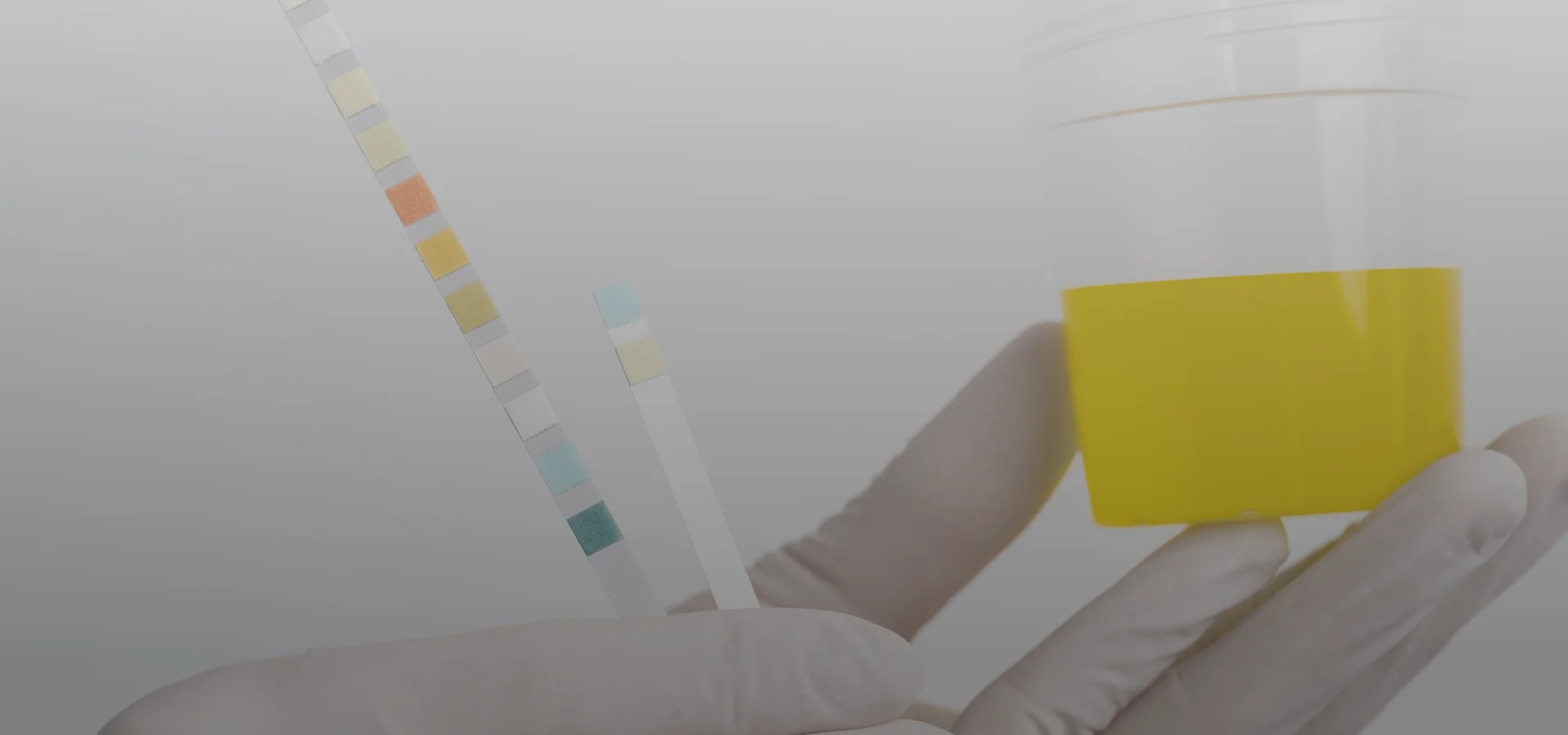 Fentanyl stay in urine